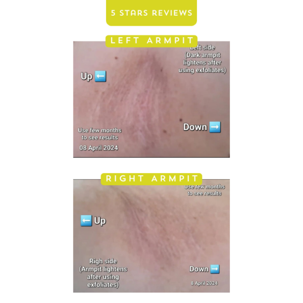 Exfoliate Sheets: Exfoliate Dead Skin Cells to Brighten Skin & Lighten Spots - Image 5