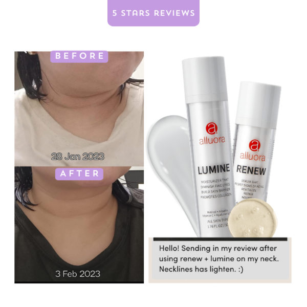 Renew Serum: Reduce Fine Lines, Neck Lines, Frown Lines, Wrinkles - Image 8