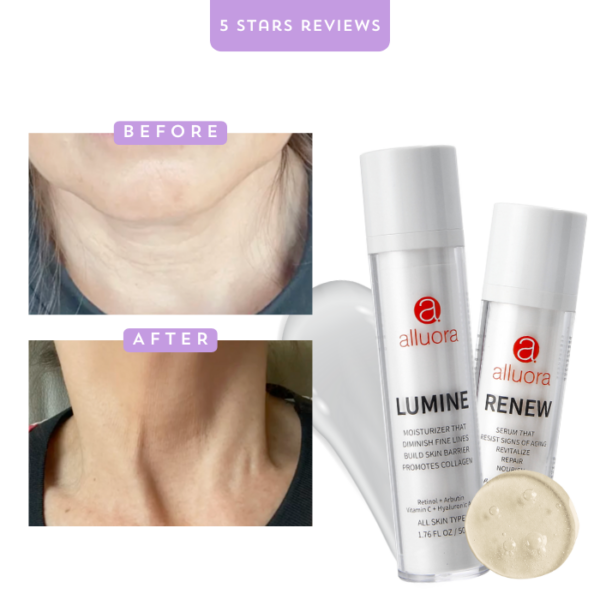 Renew Serum: Reduce Fine Lines, Neck Lines, Frown Lines, Wrinkles - Image 9