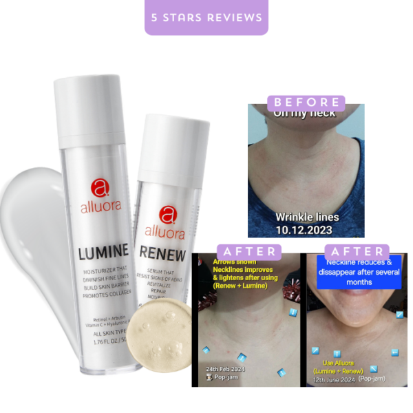 Renew Serum: Reduce Fine Lines, Neck Lines, Frown Lines, Wrinkles - Image 10